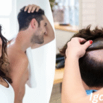 Hairpieces