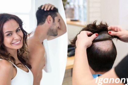 Hairpieces
