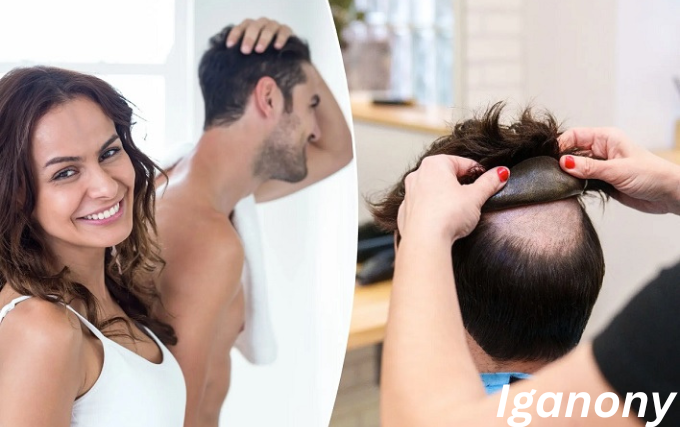 Hairpieces