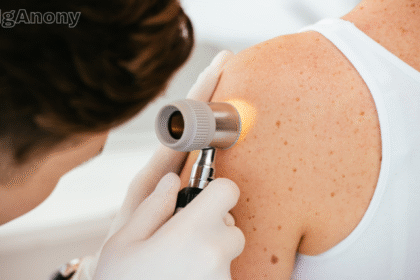 Dermatologist in Wollongong