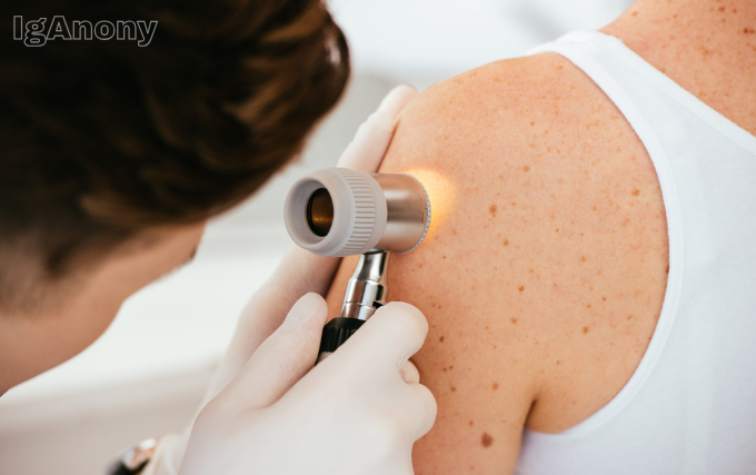 Dermatologist in Wollongong