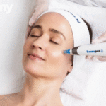 Microneedling Pen