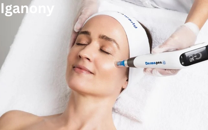 Microneedling Pen