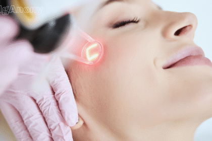 CO2 fractional laser skin resurfacing