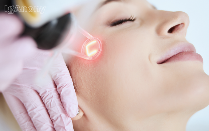 CO2 fractional laser skin resurfacing