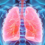 why does ozdikenosis kill you