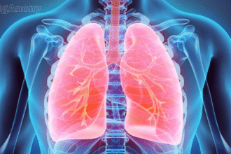 why does ozdikenosis kill you